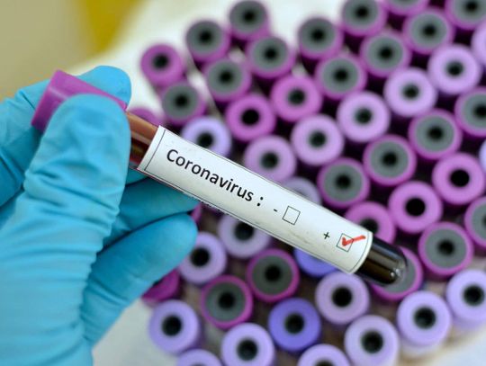 Chełm: Kolejne trzy zakażenia koronawirusem w powiecie chełmskim. Potwierdzono już 9 przypadków