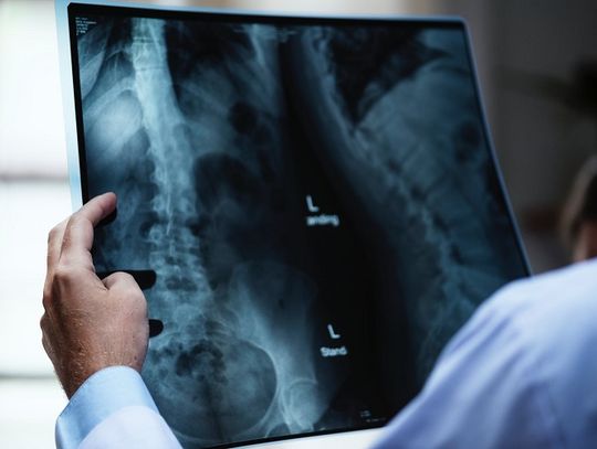 Chełm: Spór zbiorowy radiologów z chełmskim szpitalem