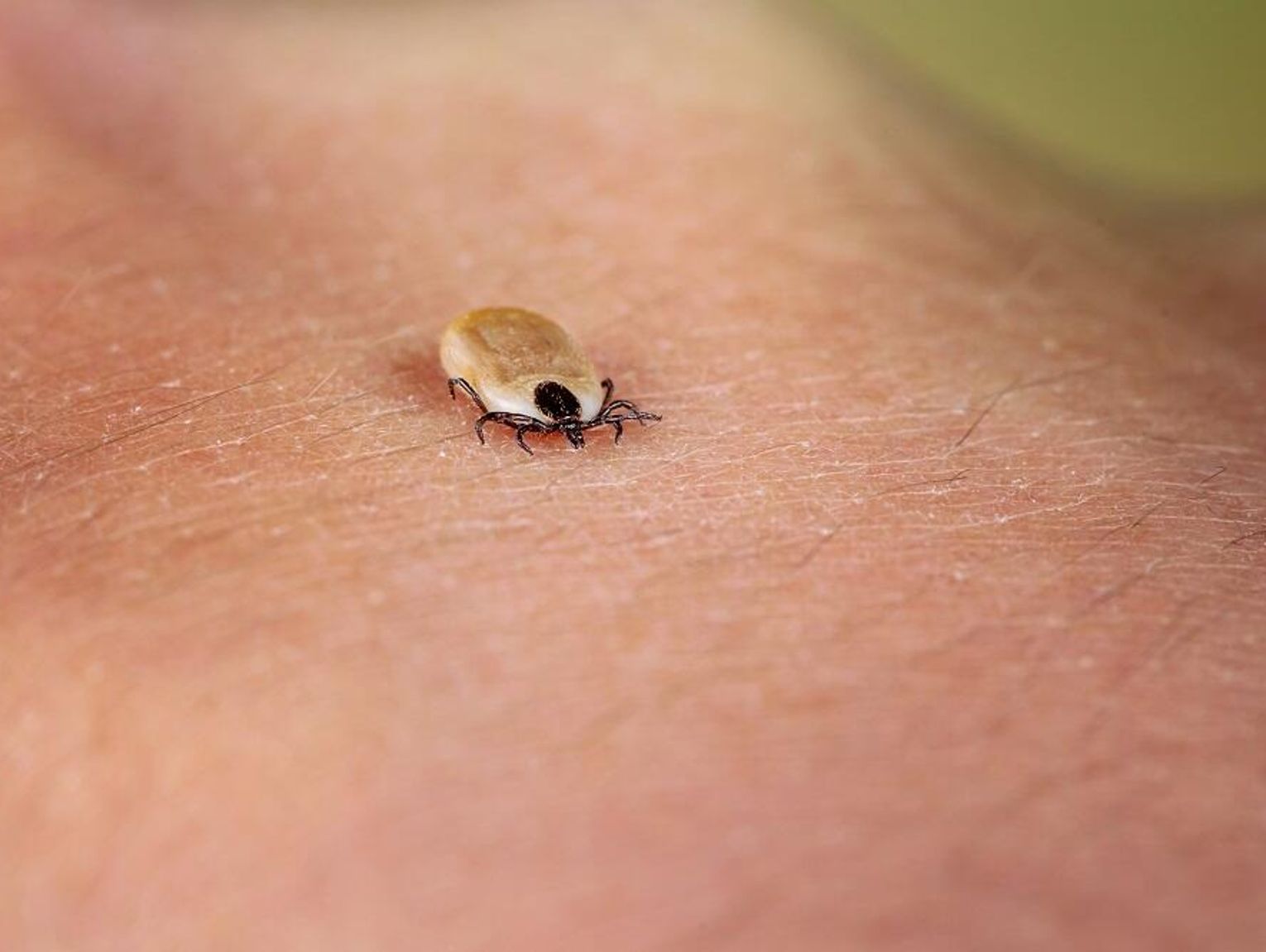 Wiadomości lokalne. Kleszcze nie odpuszczają. Ponad 100 przypadków boreliozy w 2025 roku w regionie