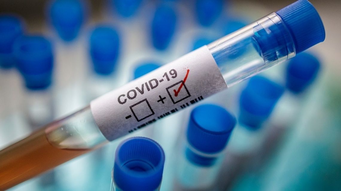 3 nowe przypadki koronawirusa w województwie. W sumie 77 przypadków zakażenia SARS-CoV-2