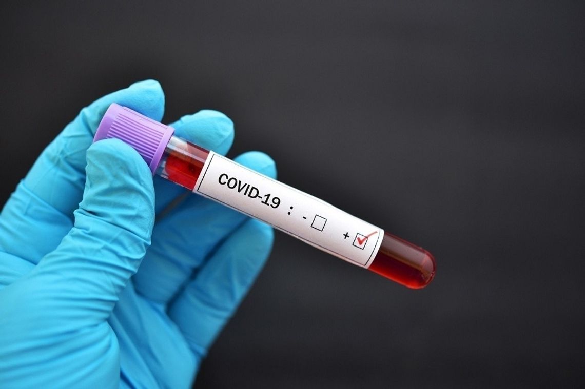 4 nowe przypadki koronawirusa w województwie. W Polsce potwierdzono już 10346 zakażeń.