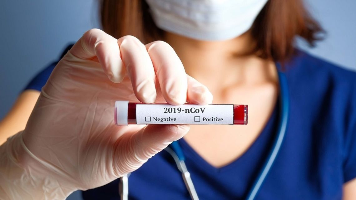 Chełm: Miasto sfinansuje testy antygenowe na koronawirusa