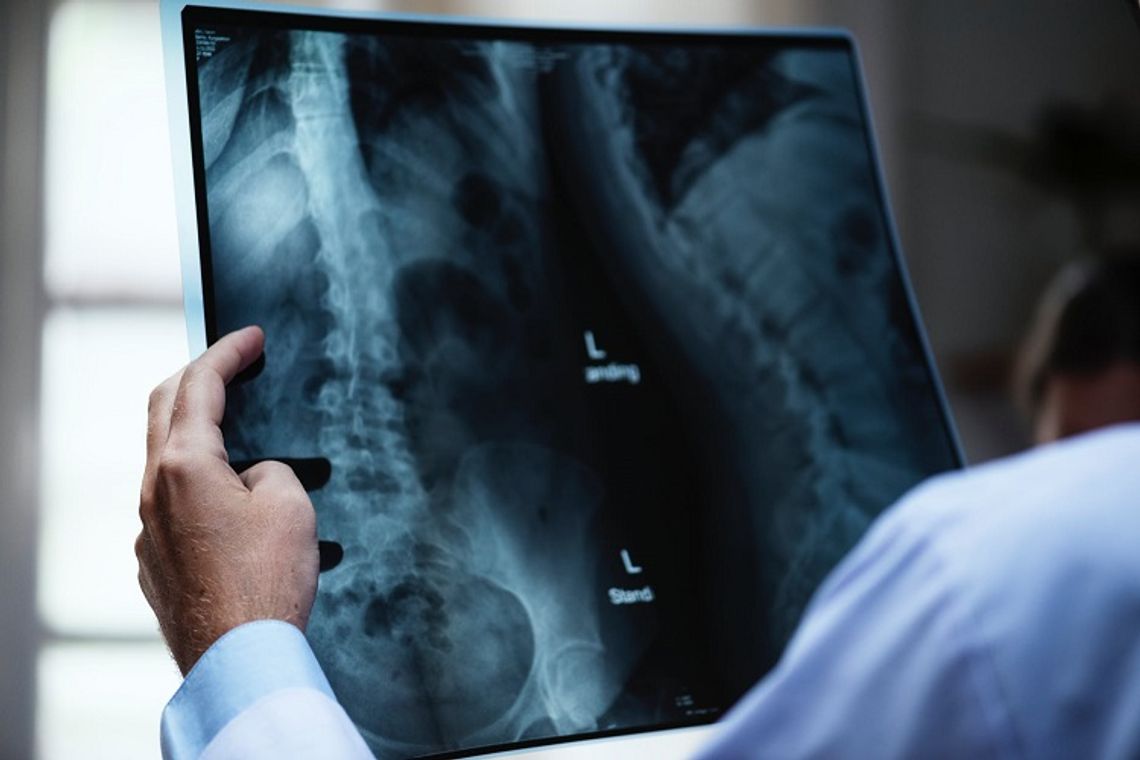 Chełm: Spór zbiorowy radiologów z chełmskim szpitalem