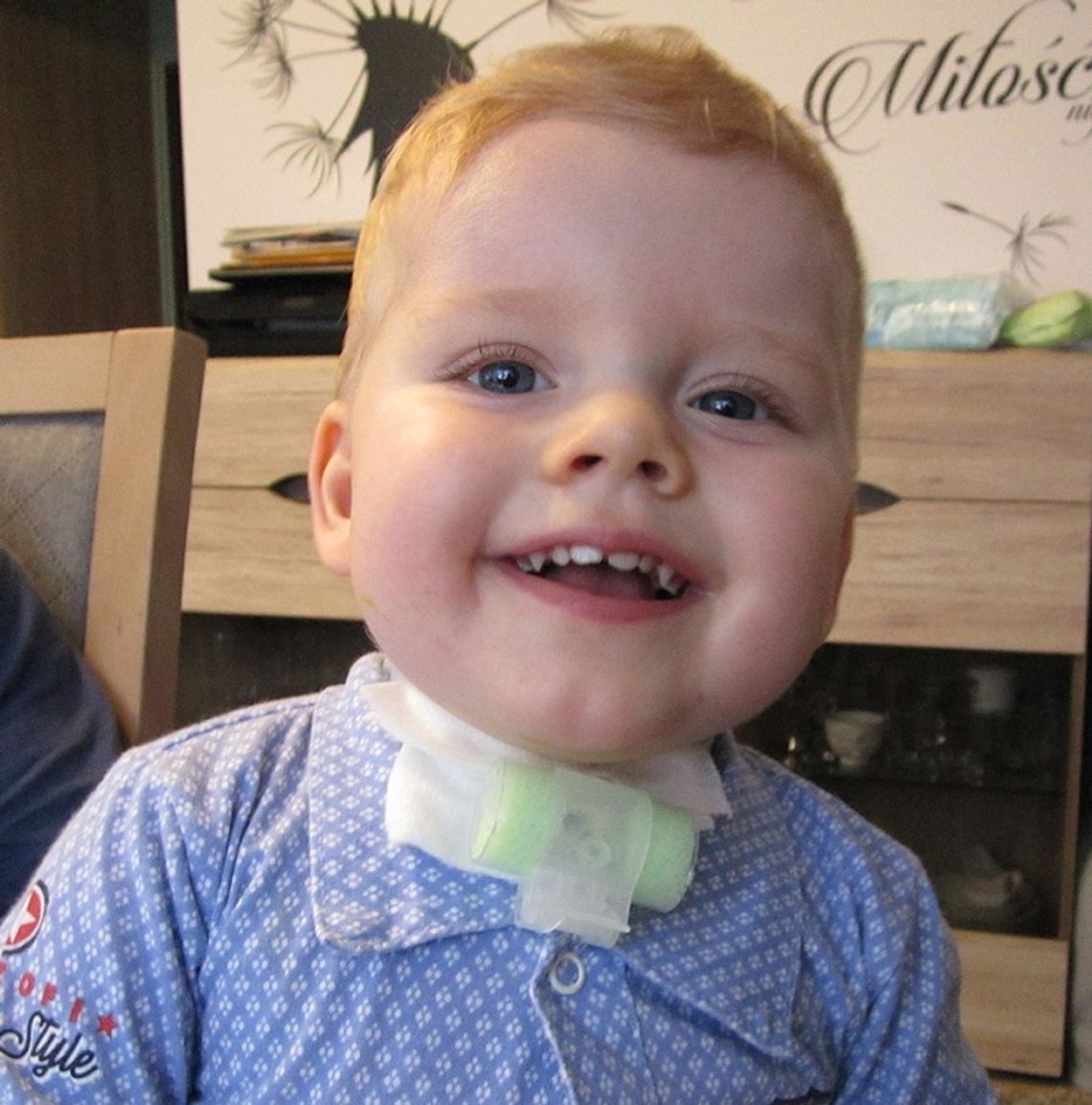 Dwuletni Miłoszek potrzebuje operacji serca. Rodzina prosi o pomoc