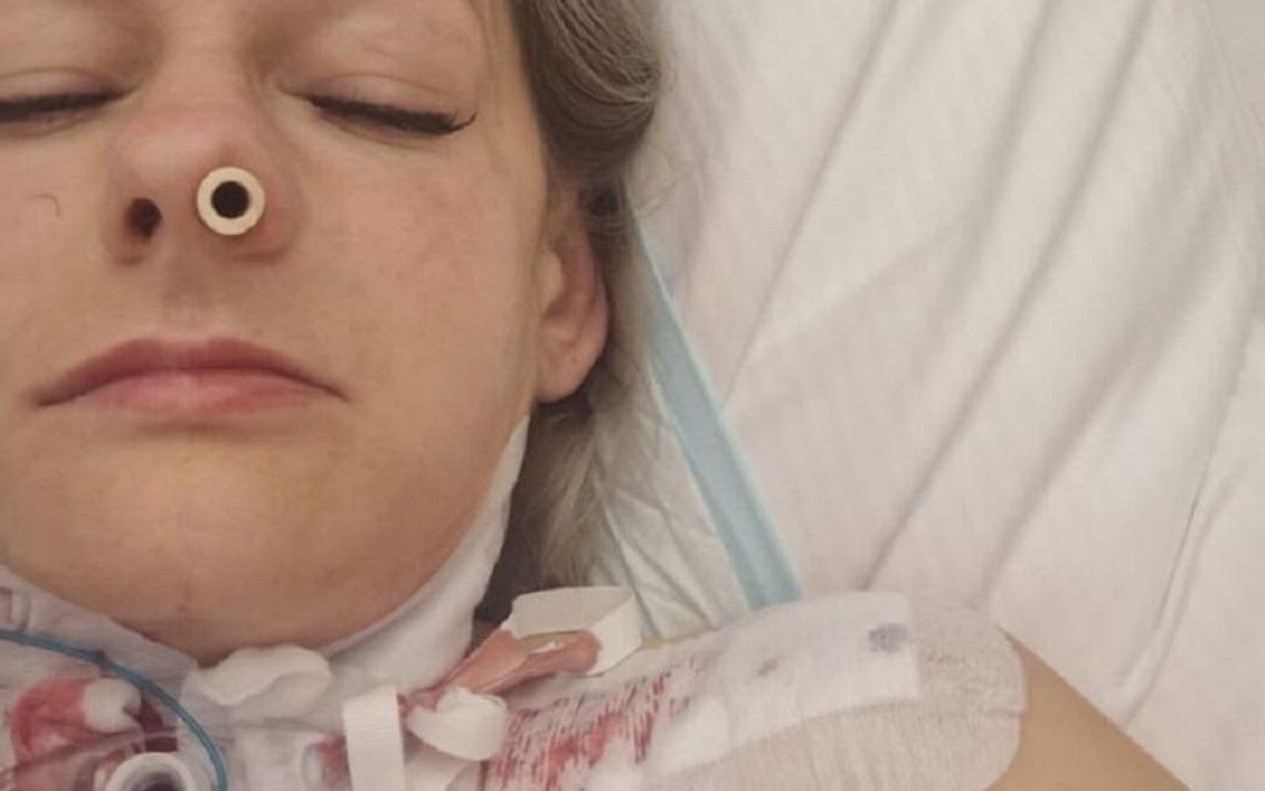 Krasnystaw. Operacja uratowała pani Katarzynie życie, teraz potrzebna jest nasza pomoc Krasnystaw. Operacja uratowała pani Katarzynie życie, teraz potrzebna jest nasza pomoc