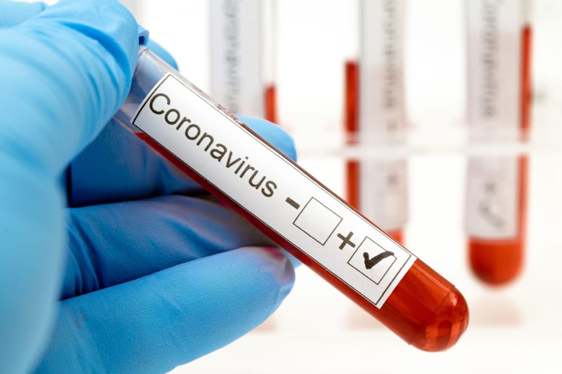 Ponad 10 tys. przypadków koronawirusa w Polsce. 7 nowych przypadków zakażenia koronawirusem w lubelskim